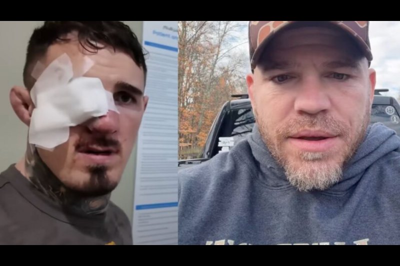 Jim Miller Blasts Eye-Poke at UFC 321: “It’s Not a F***ing Accident” - UFC Article