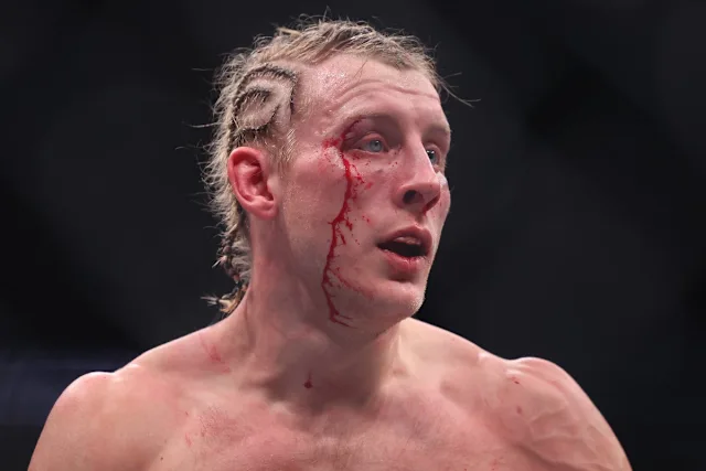 Paddy Pimblett's Crossroads: Liverpool Star Reflects on UFC Defeat and Maps Path Back to Title Contention - UFC News Article